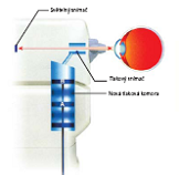 Tonometr 2